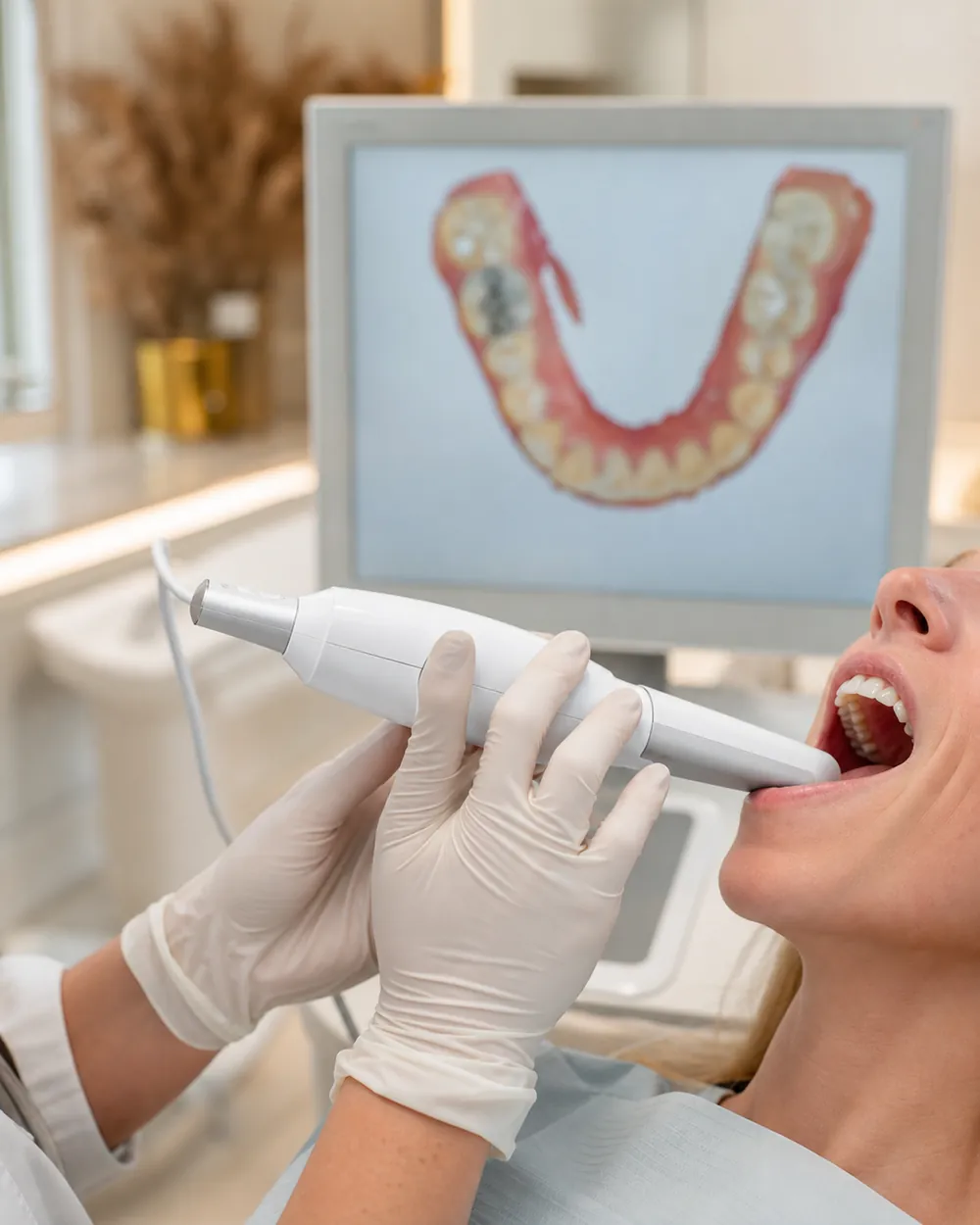 Dentist using a digital intraoral scanner to plan porcelain veneers